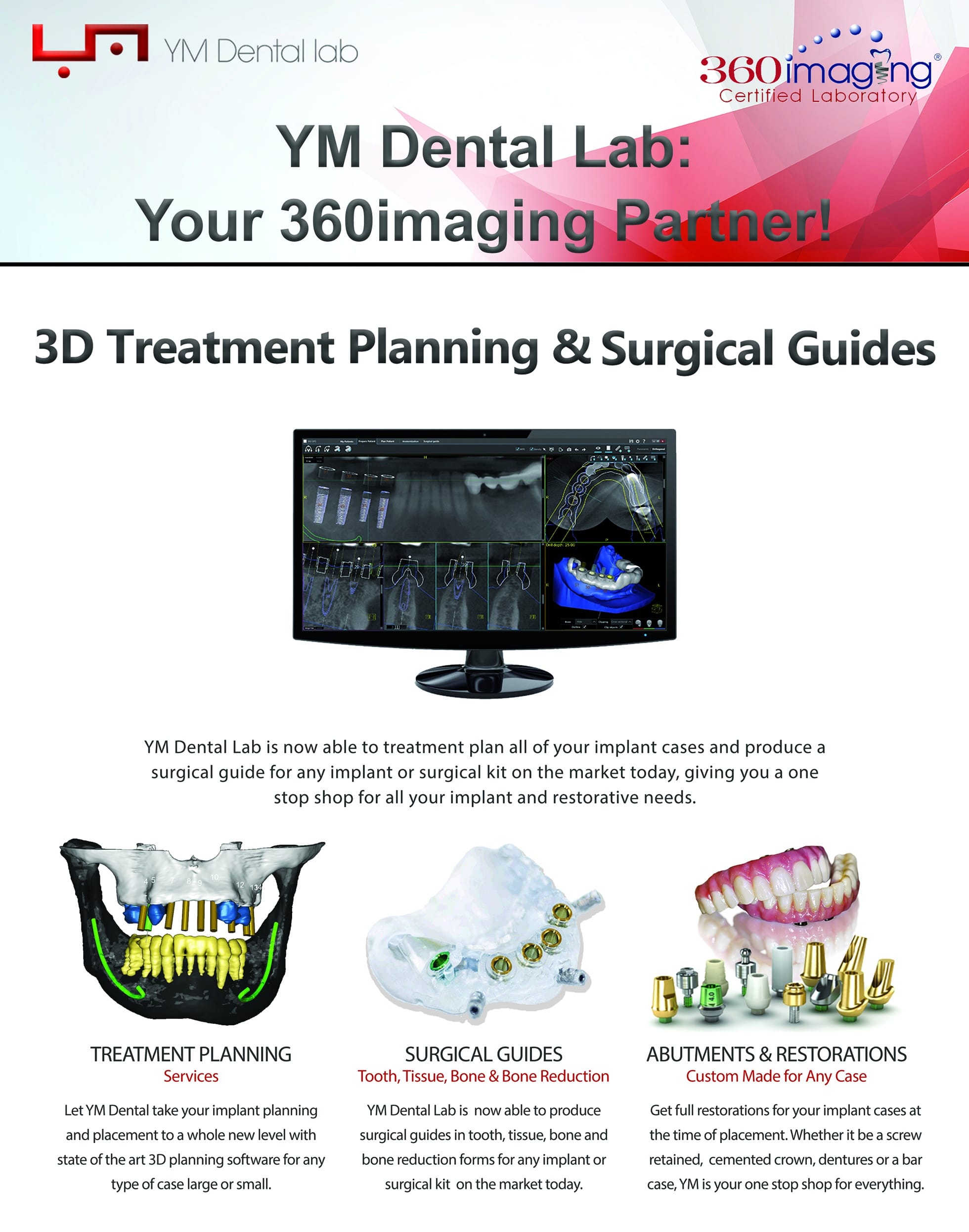 3D Treatment Planning & Surgical Guides